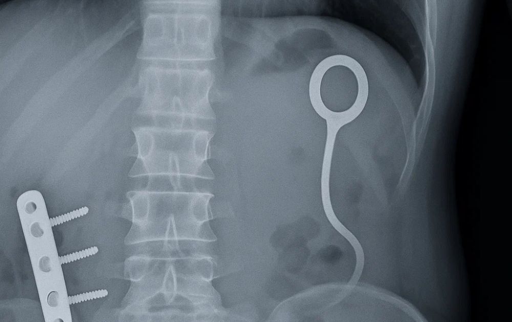 What Are Portable X-Ray Solutions