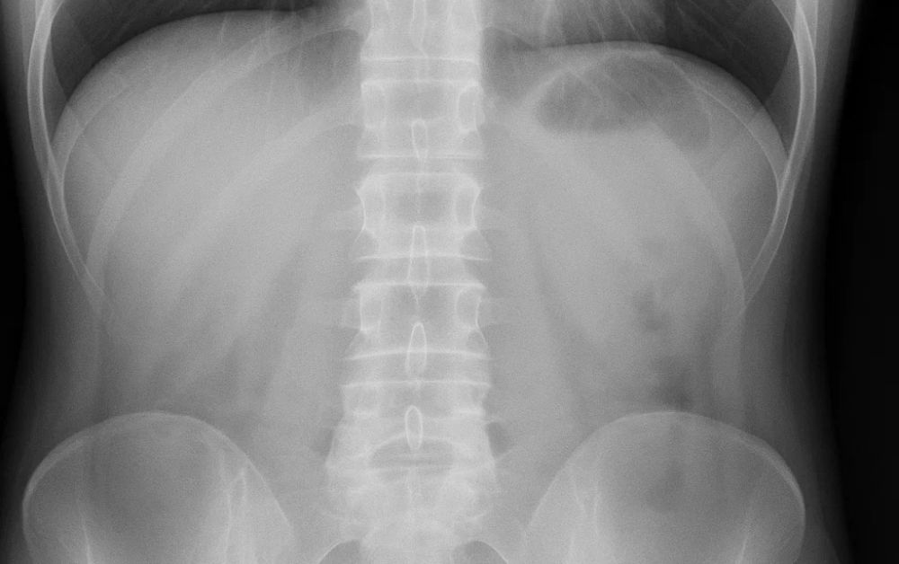 Sustainability and Environmental Considerations